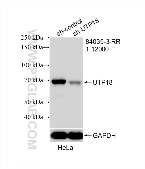 Western Blot (WB) analysis of HeLa cells using UTP18 Recombinant antibody (84035-3-RR)