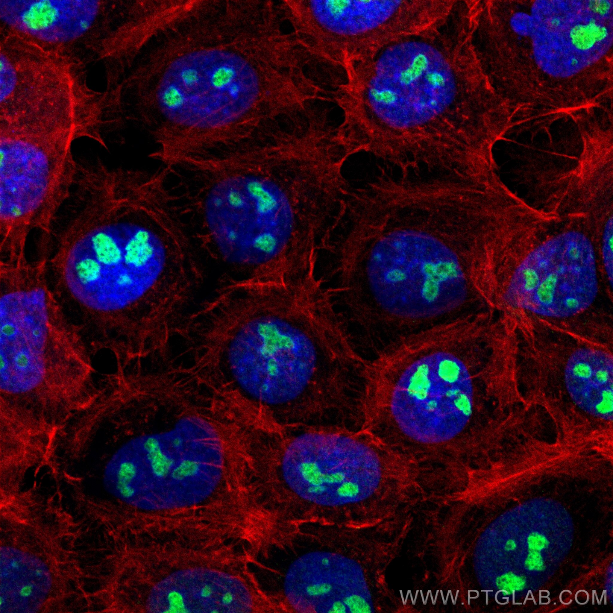 Immunofluorescence (IF) / fluorescent staining of A431 cells using CoraLite® Plus 488-conjugated UTP18 Recombinant an (CL488-84035-3)