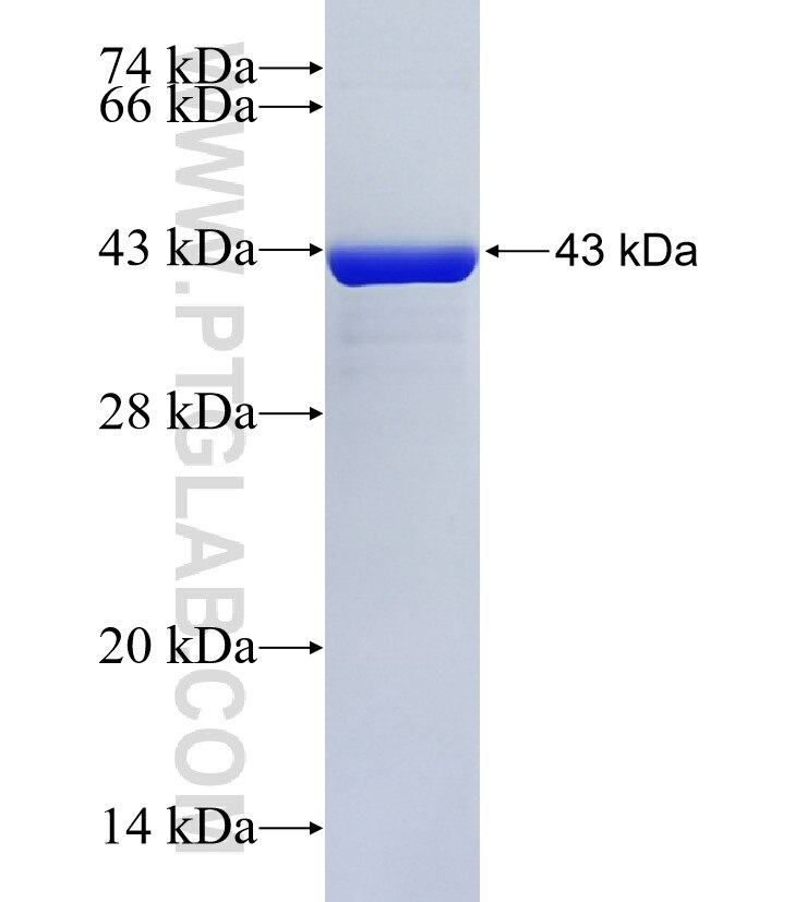 UTP18 fusion protein Ag34662 SDS-PAGE