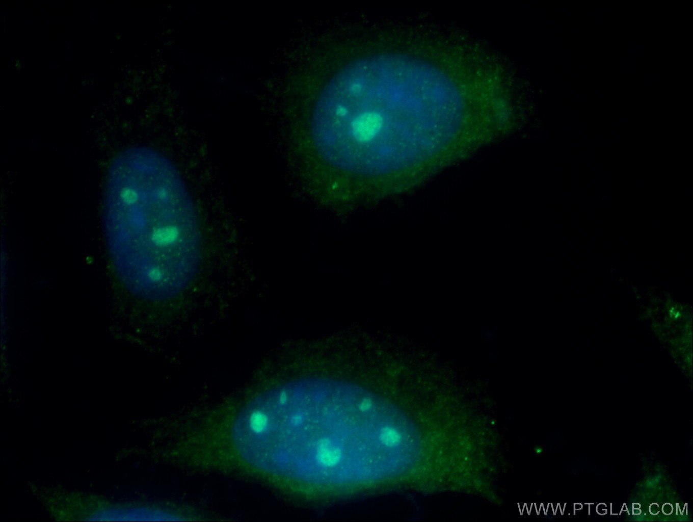 Immunofluorescence (IF) / fluorescent staining of HeLa cells using 1A6/DRIM Polyclonal antibody (18830-1-AP)