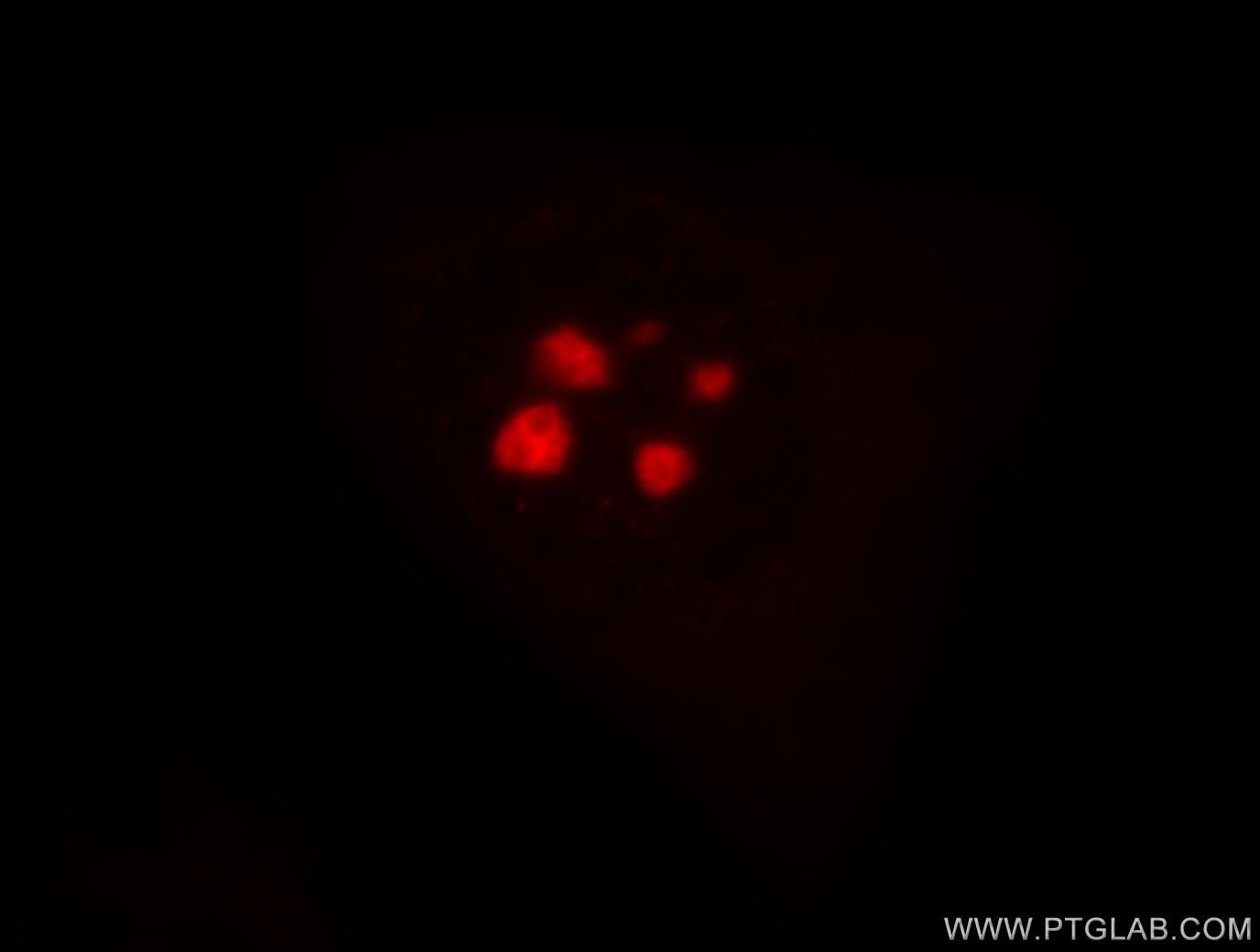 Immunofluorescence (IF) / fluorescent staining of HeLa cells using 1A6/DRIM Polyclonal antibody (18830-1-AP)