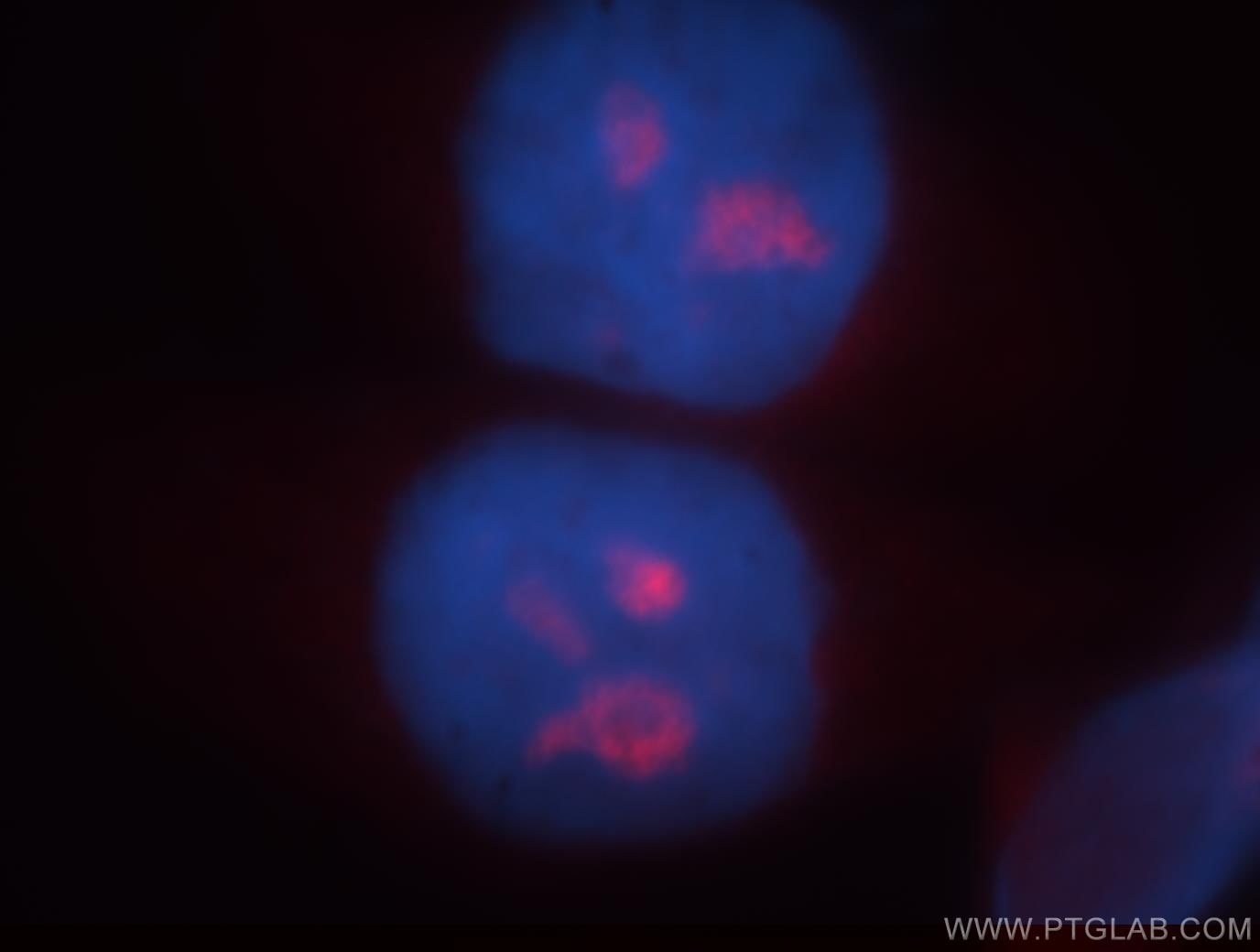 Immunofluorescence (IF) / fluorescent staining of HeLa cells using 1A6/DRIM Polyclonal antibody (18830-1-AP)