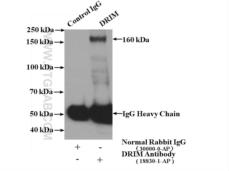 Immunoprecipitation (IP) experiment of HeLa cells using 1A6/DRIM Polyclonal antibody (18830-1-AP)