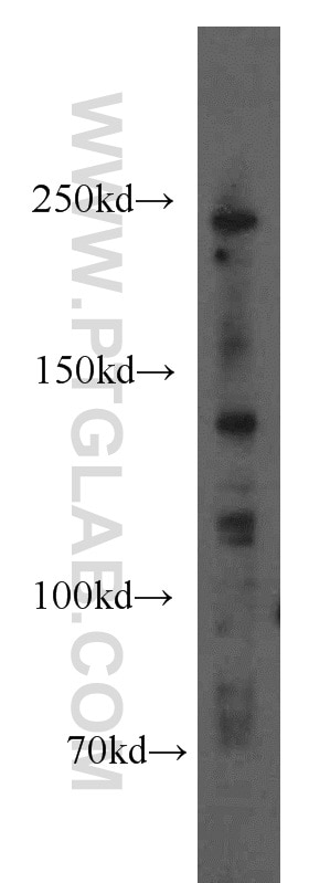 Western Blot (WB) analysis of mouse ovary tissue using 1A6/DRIM Polyclonal antibody (18830-1-AP)
