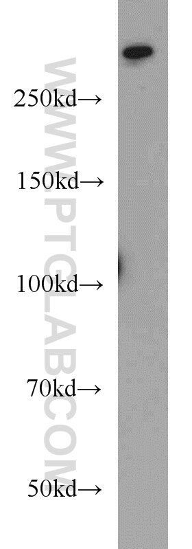 Western Blot (WB) analysis of HeLa cells using 1A6/DRIM Polyclonal antibody (18830-1-AP)