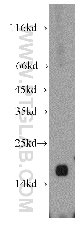 Western Blot (WB) analysis of mouse liver tissue using UTP23 Polyclonal antibody (15950-1-AP)