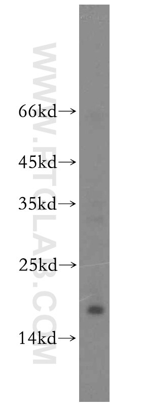 Western Blot (WB) analysis of mouse liver tissue using UTP23 Polyclonal antibody (15950-1-AP)