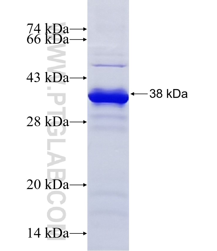 UTP23 fusion protein Ag8524 SDS-PAGE