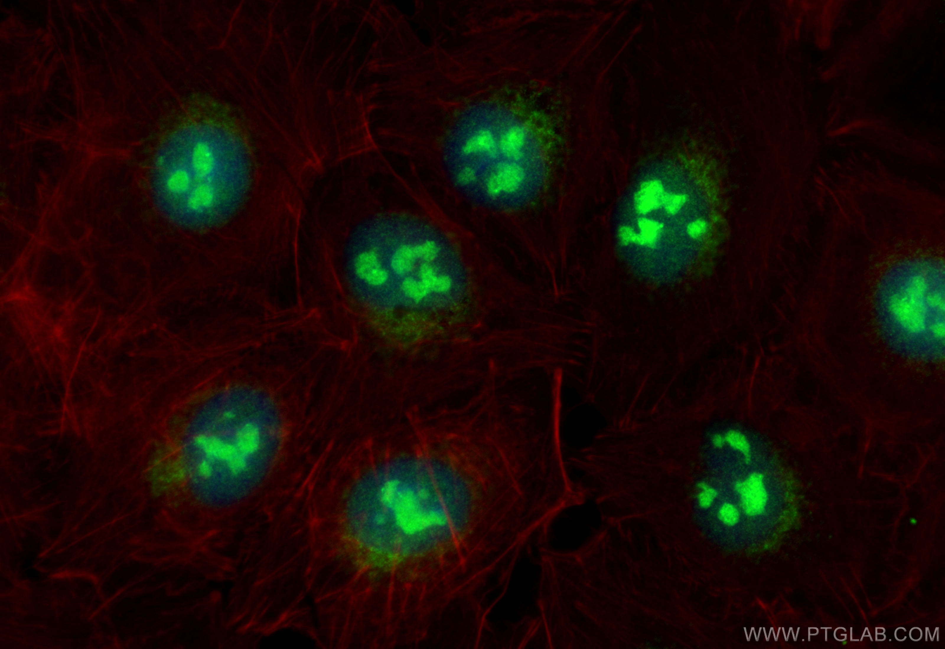 Immunofluorescence (IF) / fluorescent staining of A549 cells using UTP3 Polyclonal antibody (18886-1-AP)