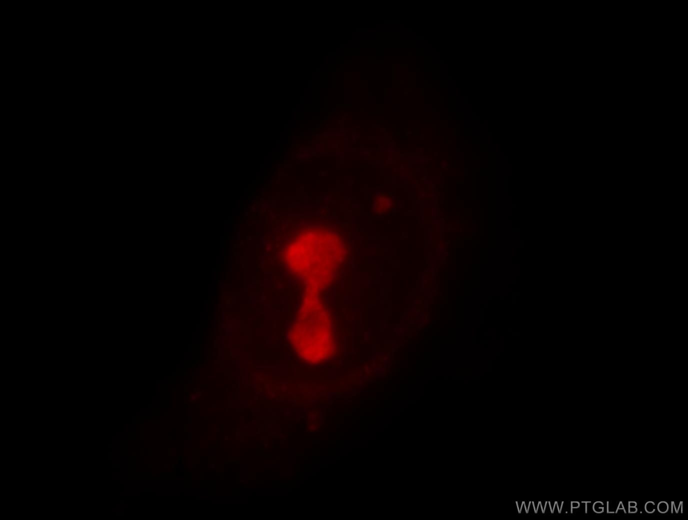 Immunofluorescence (IF) / fluorescent staining of HeLa cells using UTP3 Polyclonal antibody (18886-1-AP)