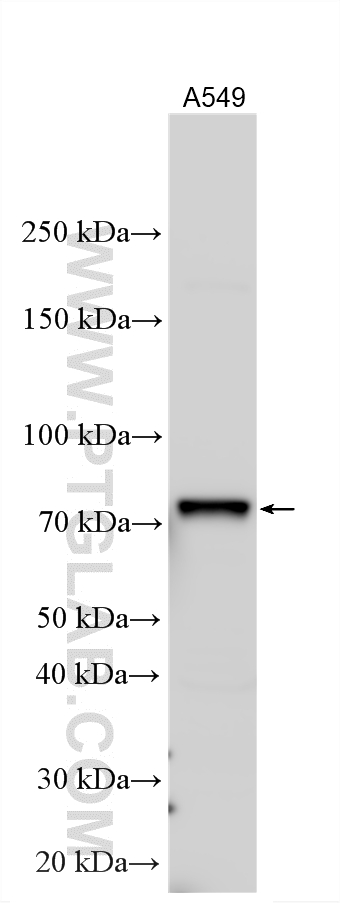 Various lysates were subjected to SDS PAGE followed by western blot with 18886-1-AP (UTP3 antibody) at dilution of 1:2000 incubated at room temperature for 1.5 hours. Western Blot (WB) analysis of various lysates using UTP3 Polyclonal antibody (18886-1-AP)