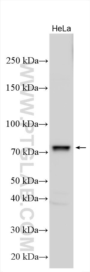 Western Blot (WB) analysis of various lysates using UTP3 Polyclonal antibody (18886-1-AP)