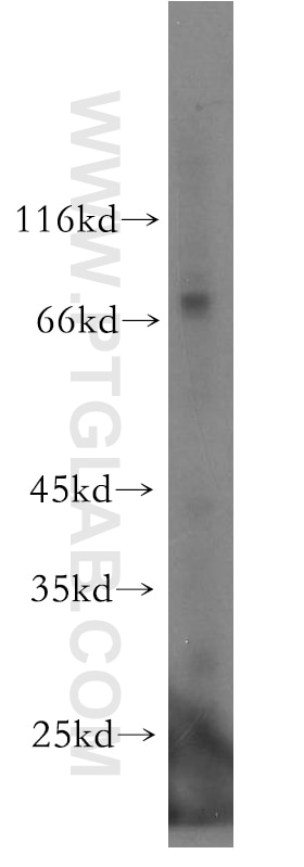 Western Blot (WB) analysis of human brain tissue using UTP3 Polyclonal antibody (18886-1-AP)