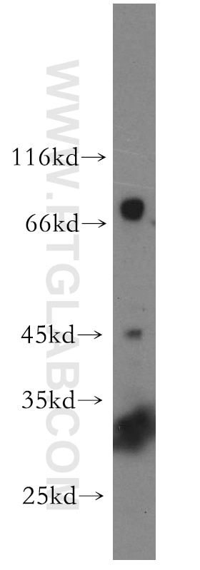 Western Blot (WB) analysis of HeLa cells using UTP3 Polyclonal antibody (18886-1-AP)