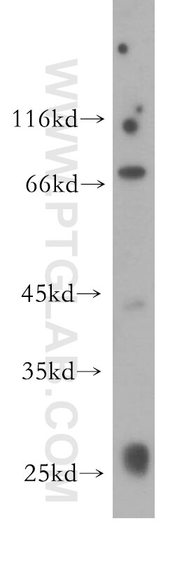Western Blot (WB) analysis of mouse thymus tissue using UTP3 Polyclonal antibody (18886-1-AP)