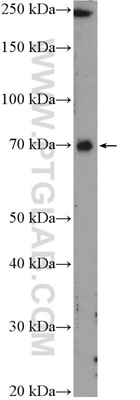 Western Blot (WB) analysis of HEK-293 cells using UTP6 Polyclonal antibody (17671-1-AP)