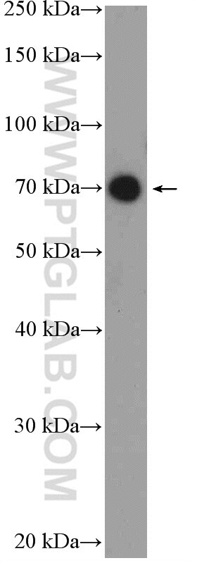 Western Blot (WB) analysis of HeLa cells using UTP6 Polyclonal antibody (17671-1-AP)