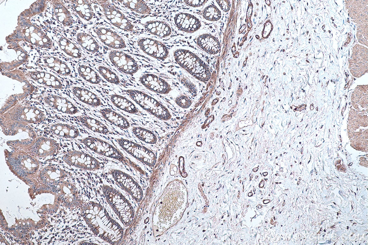 Immunohistochemistry (IHC) staining of human colon tissue using UTRN Polyclonal antibody (27948-1-AP)