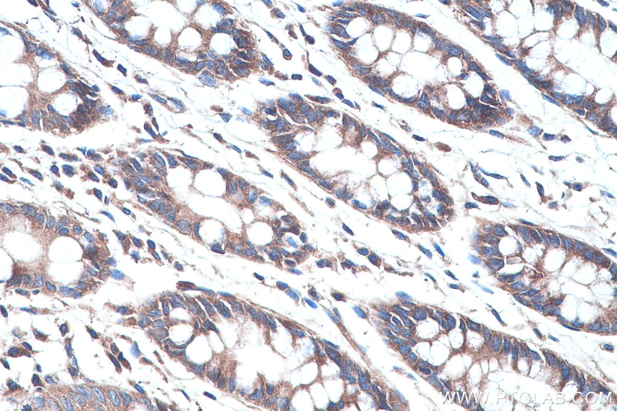 Immunohistochemistry (IHC) staining of human colon tissue using UTRN Polyclonal antibody (27948-1-AP)