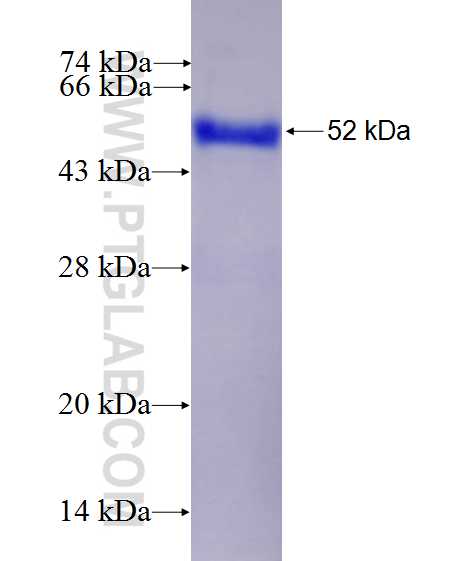 UTRN fusion protein Ag27497 SDS-PAGE