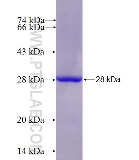 UTRN fusion protein Ag27509 SDS-PAGE