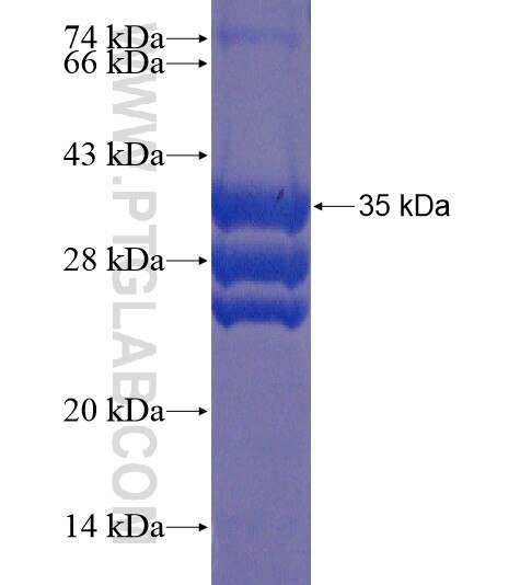 UTS2R fusion protein Ag21637 SDS-PAGE