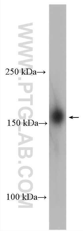 Western Blot (WB) analysis of COLO 320 cells using UTX Polyclonal antibody (23984-1-AP)
