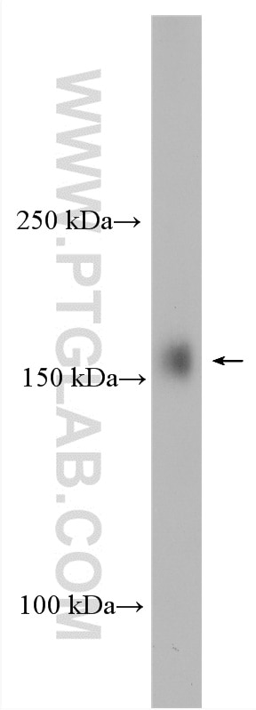 Western Blot (WB) analysis of HepG2 cells using UTX Polyclonal antibody (23984-1-AP)