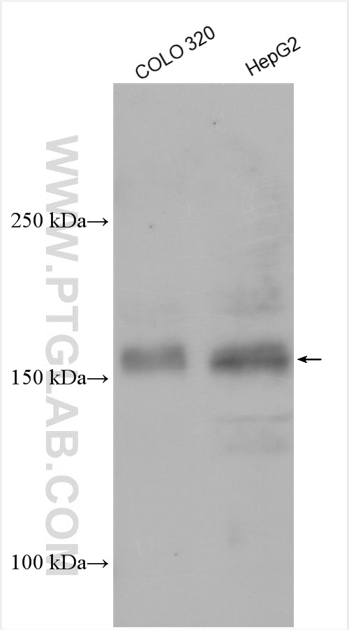 Western Blot (WB) analysis of various lysates using UTX Polyclonal antibody (23984-1-AP)