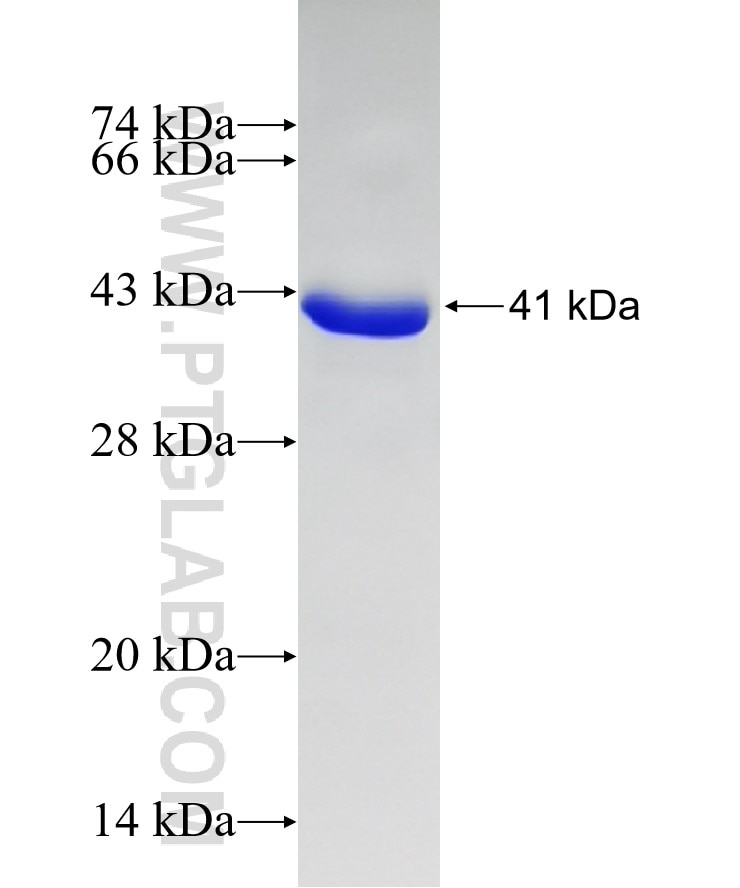 UTX fusion protein Ag20018 SDS-PAGE