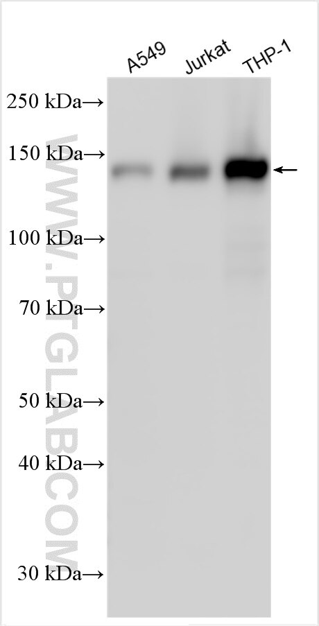 Western Blot (WB) analysis of various lysates using UTY Polyclonal antibody (31546-1-AP)