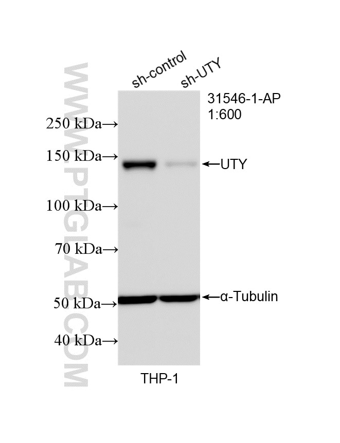 WB analysis of THP-1 using 31546-1-AP (same clone as 31546-1-PBS) Western Blot (WB) analysis of THP-1 cells using UTY Polyclonal antibody (31546-1-AP)