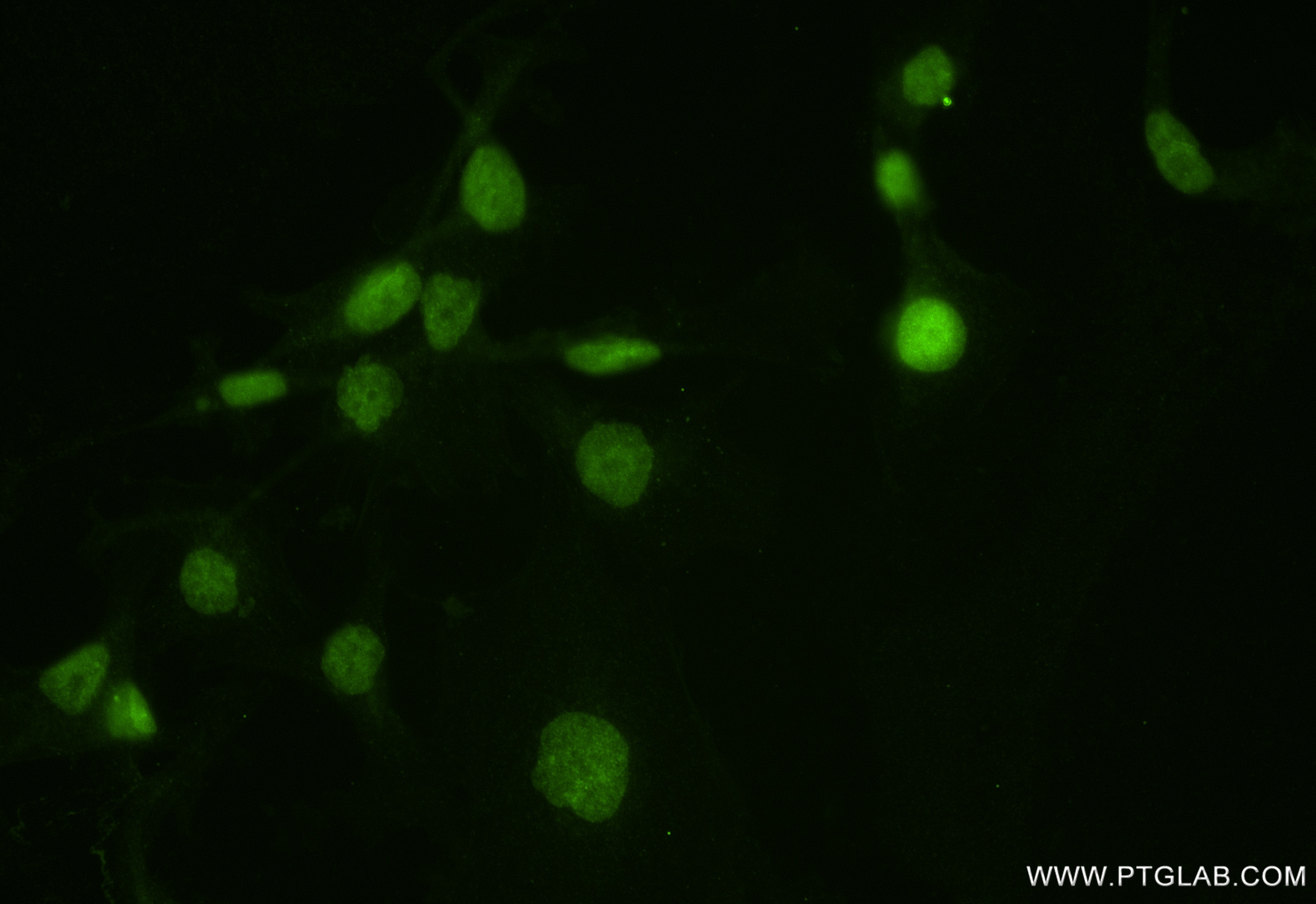 Immunofluorescence (IF) / fluorescent staining of MDA-MB-231 cells using UTY Recombinant antibody (84332-5-RR)