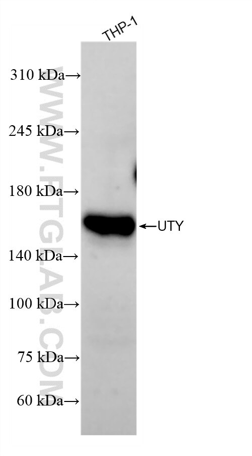 Western Blot (WB) analysis of various lysates using UTY Recombinant antibody (84332-5-RR)