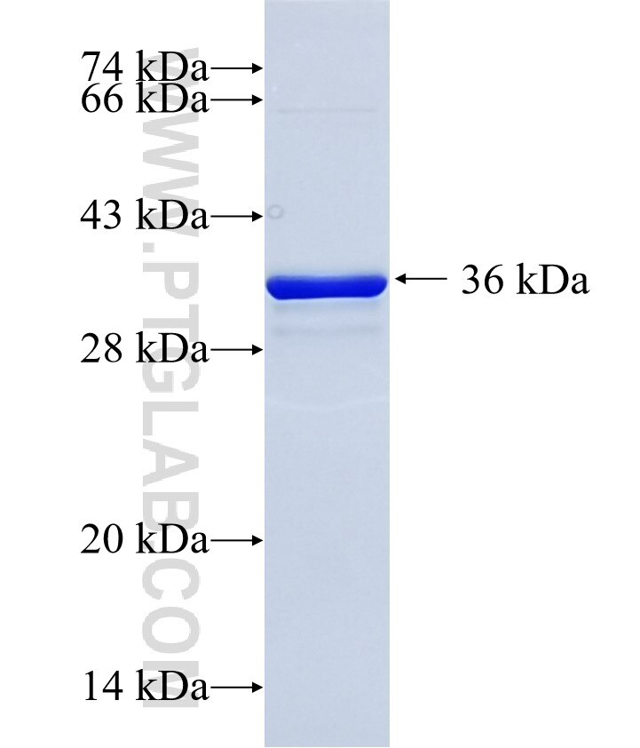 UTY fusion protein Ag35806 SDS-PAGE
