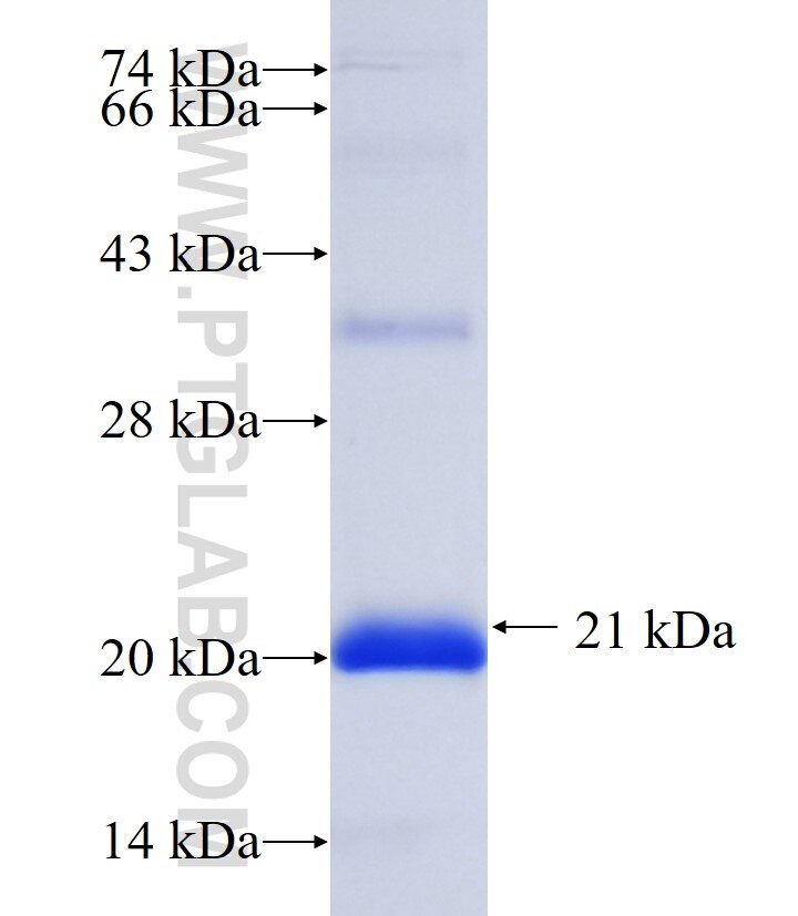 UTY fusion protein Ag35842 SDS-PAGE UTY fusion protein Ag35842 SDS-PAGE