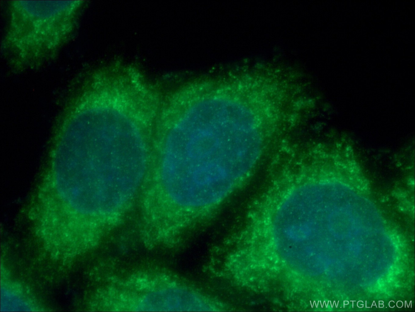 Immunofluorescence (IF) / fluorescent staining of HepG2 cells using UVRAG Polyclonal antibody (19571-1-AP)