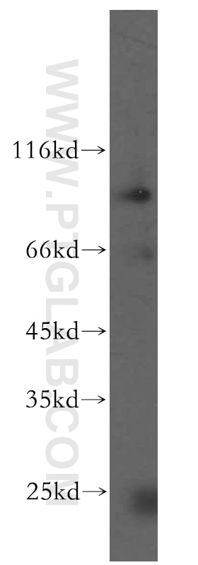 Western Blot (WB) analysis of human brain tissue using UVRAG Polyclonal antibody (19571-1-AP)