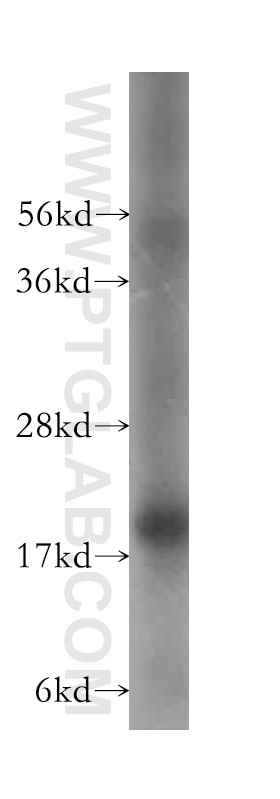 Western Blot (WB) analysis of HeLa cells using UXT Polyclonal antibody (11047-1-AP)