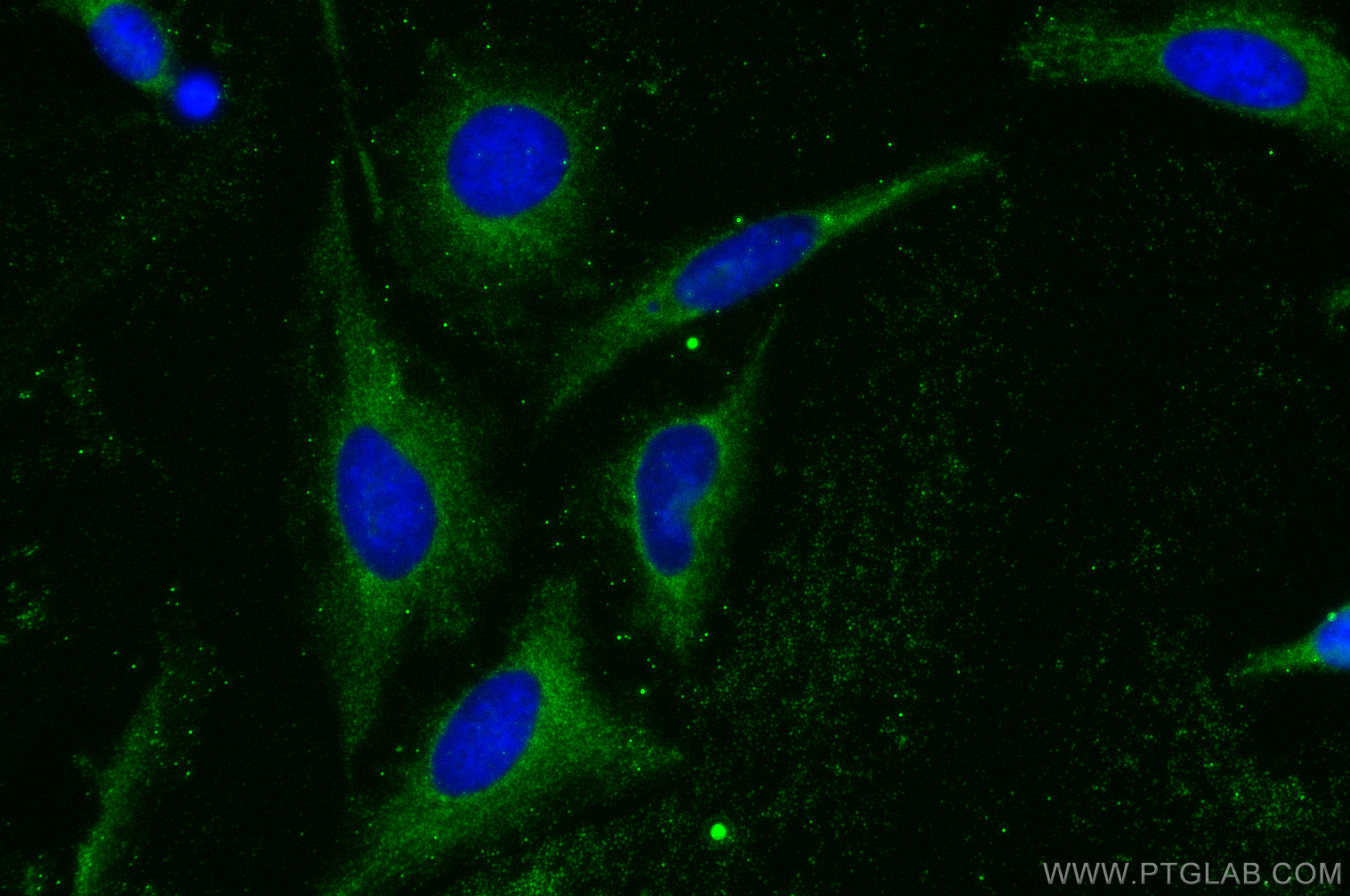 Immunofluorescence (IF) / fluorescent staining of HeLa cells using Ubiquilin 1 Polyclonal antibody (22126-1-AP)