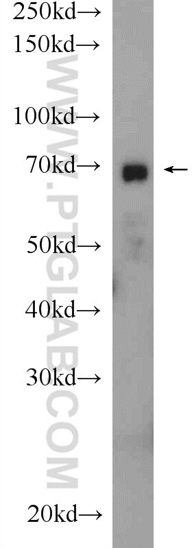 WB analysis of rat heart using 22126-1-AP