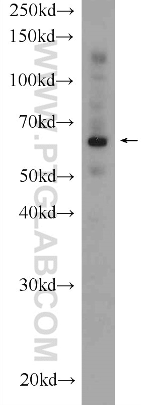 Western Blot (WB) analysis of rat liver tissue using Ubiquilin 1 Polyclonal antibody (22126-1-AP)