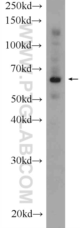 WB analysis of rat liver using 22126-1-AP