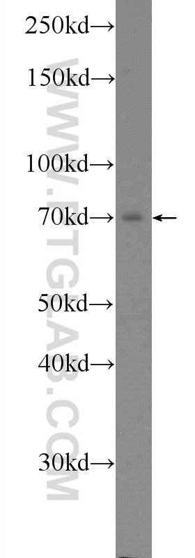 Western Blot (WB) analysis of L02 cells using Ubiquilin 1 Polyclonal antibody (22126-1-AP)