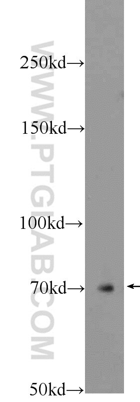 Western Blot (WB) analysis of rat brain tissue using Ubiquilin 1 Polyclonal antibody (22126-1-AP)