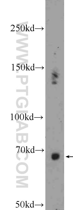 Western Blot (WB) analysis of rat liver tissue using Ubiquilin 1 Polyclonal antibody (22126-1-AP)