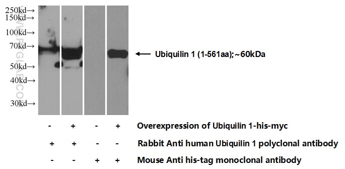 Western Blot (WB) analysis of Transfected HEK-293 cells using Ubiquilin 1 Polyclonal antibody (22126-1-AP)