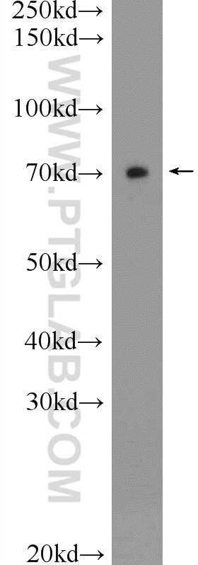 Western Blot (WB) analysis of rat brain tissue using Ubiquilin 1 Polyclonal antibody (23516-1-AP)