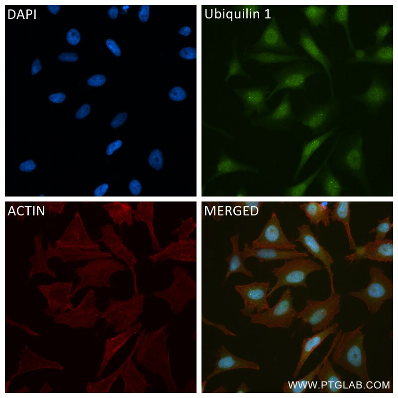 Immunofluorescence (IF) / fluorescent staining of HeLa cells using Ubiquilin 1 Recombinant antibody (84649-2-RR)
