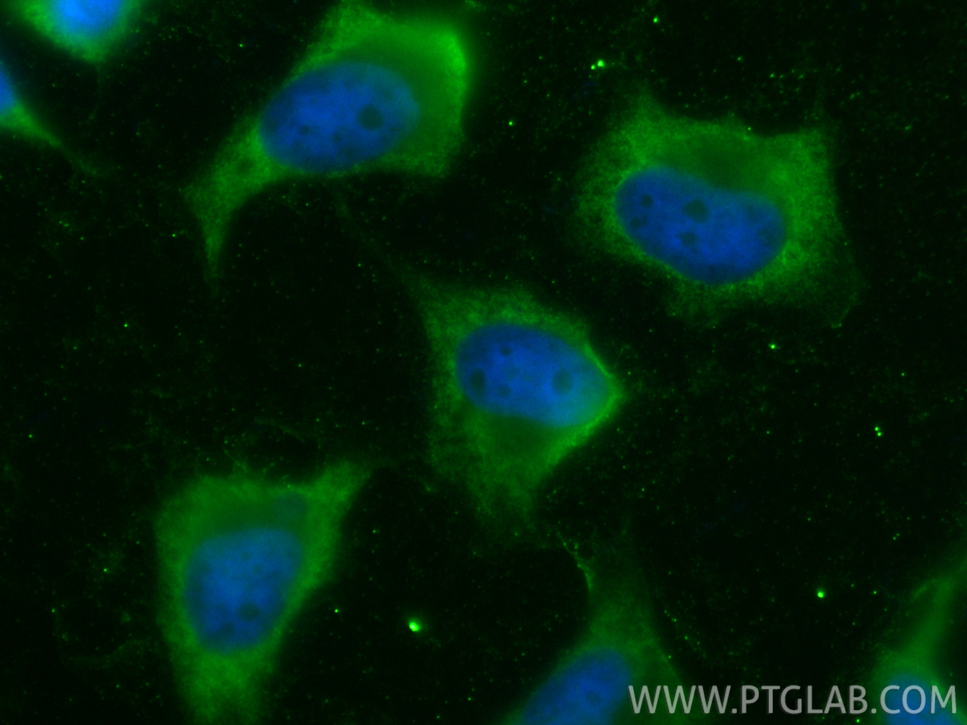 IF Staining of HeLa using CL488-84649-2 Immunofluorescence (IF) / fluorescent staining of HeLa cells using CoraLite® Plus 488-conjugated Ubiquilin 1 Recombin (CL488-84649-2)